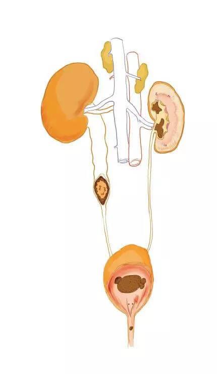 狗狗尿结石不可忽视，尿结石是影响狗狗身体健康的罪魁祸首