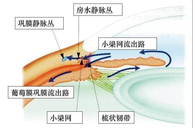 狗狗原发性闭角型青光眼手术治疗