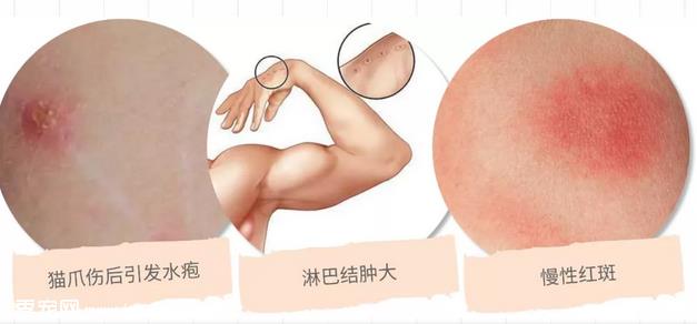 你对人猫共患疾病了解多少?
